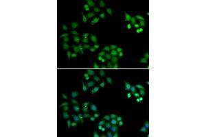 Immunofluorescence analysis of HeLa cells using NSFL1C antibody (ABIN5974024). (NSFL1C antibody)