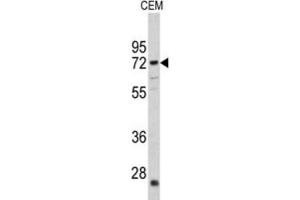 Western Blotting (WB) image for anti-Carnitine O-Acetyltransferase (CRAT) antibody (ABIN3002687) (CRAT antibody)