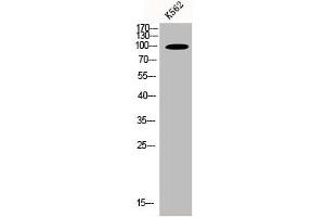 Western Blot analysis of K562 cells using N4BP1 Polyclonal Antibody (N4BP1 antibody  (Internal Region))