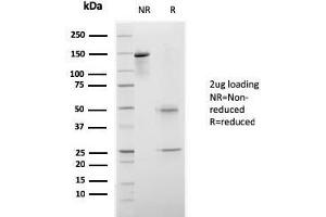 SDS-PAGE Analysis Purified CELA3B Recombinant Mouse Monoclonal Antibody (rCELA3B/1811).