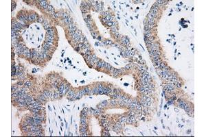 Immunohistochemistry (IHC) image for anti-3-hydroxyisobutyryl-CoA Hydrolase (HIBCH) antibody (ABIN1498658) (HIBCH antibody)