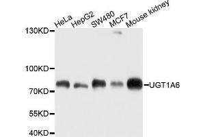Western blot analysis of extracts of various cells, using UGT1A6 antibody. (UGT1A6 antibody)