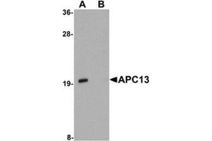 Western blot analysis of APC13 in Jurkat cell tissue lysate with APC13 antibody at 1 μg/ml in (A) the absence and (B) the presence of blocking peptide. (ANAPC13 antibody  (Center))