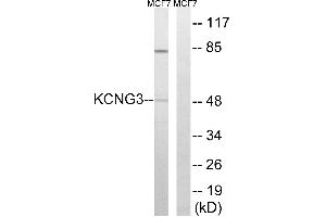 Western blot analysis of extracts from MCF-7 cells, using KCNG3 antibody. (KCNG3 antibody  (Internal Region))