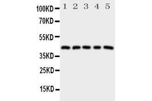Western Blotting (WB) image for anti-Prostaglandin E Receptor 1 (Subtype EP1), 42kDa (PTGER1) (AA 387-404), (C-Term) antibody (ABIN3043155) (PTGER1 antibody  (C-Term))