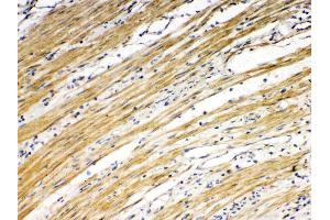 Immunohistochemistry (IHC) image for anti-Tumor Necrosis Factor Receptor Superfamily, Member 10b (TNFRSF10B) (AA 233-440) antibody (ABIN5518794)