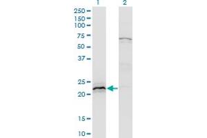 Western Blot analysis of HN1 expression in transfected 293T cell line by HN1 monoclonal antibody (M02), clone 3G6.