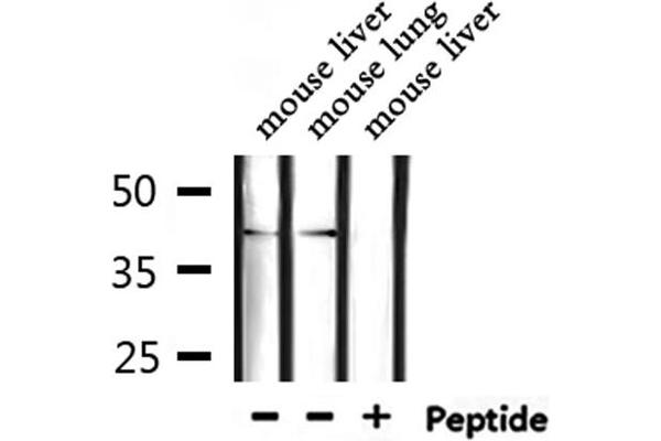 TSSK1B antibody  (Internal Region)