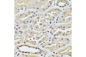 Immunohistochemistry of paraffin-embedded human kidney using SP110 Antibody (ABIN6290941) at dilution of 1:100 (40x lens).