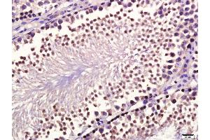 Paraformaldehyde-fixed, paraffin embedded mouse testis, Antigen retrieval by boiling in sodium citrate buffer (pH6. (GDF10 antibody  (AA 371-478))