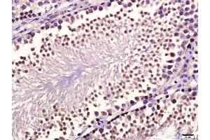 Paraformaldehyde-fixed, paraffin embedded mouse testis, Antigen retrieval by boiling in sodium citrate buffer (pH6. (GDF10 antibody  (AA 371-478))