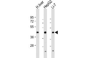 All lanes : Anti-CREB3L3 Antibody (Center) at 1:1000-1:2000 dilution Lane 1: human liver lysate Lane 2: HepG2 whole cell lysate Lane 3: Li-7 whole cell lysate Lysates/proteins at 20 μg per lane.
