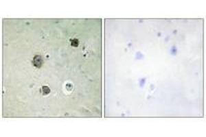 Immunohistochemistry analysis of paraffin-embedded human brain tissue using CDK5 (Ab-15) antibody. (CDK5 antibody  (Tyr15))