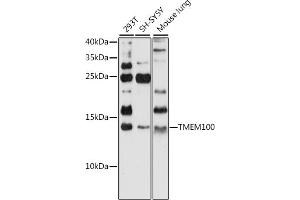 Western blot analysis of extracts of various cell lines, using TMEM100 antibody (ABIN7270950) at 1:1000 dilution. (TMEM100 antibody  (C-Term))