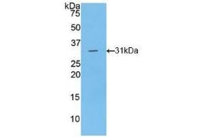 Detection of Recombinant LIPG, Human using Polyclonal Antibody to Lipase, Endothelial (LIPG) (LIPG antibody  (AA 175-412))