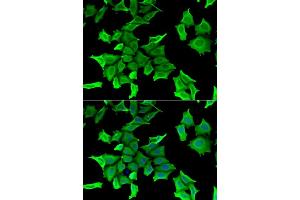 Immunofluorescence analysis of HeLa cells using SPINT2 antibody (ABIN6132838, ABIN6148361, ABIN6148362 and ABIN6222480).