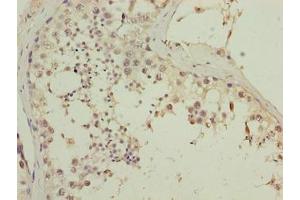 Immunohistochemistry of paraffin-embedded human testis tissue using ABIN7147501 at dilution of 1:100 (CGGBP1 antibody  (AA 1-167))