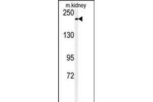 Western blot analysis of anti-CHAK1 Antibody (C-term) (ABIN392614 and ABIN2837991) in mouse kidney tissue lysates (35 μg/lane). (TRPM7 antibody  (C-Term))