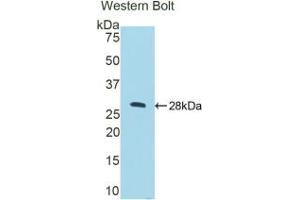 Western blot analysis of the recombinant protein. (CTSC antibody  (AA 231-462))