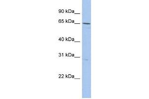 WB Suggested Anti-DQX1 Antibody Titration:  0. (DQX1 antibody  (N-Term))