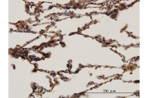 Immunoperoxidase of monoclonal antibody to HBB on formalin-fixed paraffin-embedded human lung. (Hemoglobin Subunit beta antibody  (AA 38-147))