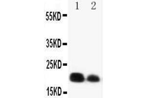 Anti-IL-6 antibody, Western blotting Lane 1: Recombinant Mouse IL-4 Protein 10ng Lane 2: Recombinant Mouse IL-4 Protein 5ng