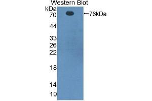Western blot analysis of recombinant Rat CTTN.
