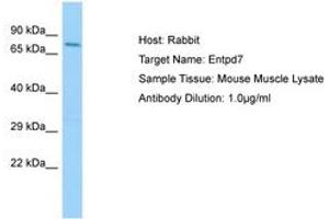 ENTPD7 antibody  (AA 449-498)