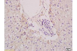 Formalin-fixed and paraffin embedded mouse liver tissue labeled with Anti EPHX2 Polyclonal Antibody,Unconjugated (ABIN750553) at 1:200 followed by conjugation to the secondary antibody and DAB staining. (EPHX2 antibody  (AA 351-450))