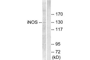 Western blot analysis of extracts from NIH/3T3 cells, using NOS2 antibody (ABIN5976446).