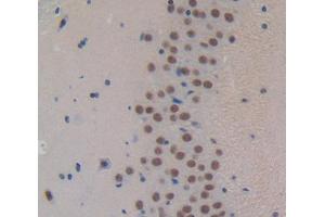 IHC-P analysis of Kidney tissue, with DAB staining. (FOXP1 antibody  (AA 122-346))