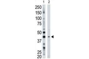 Western Blotting (WB) image for anti-ADP-Ribosyltransferase 3 (ART3) antibody (ABIN3001504)