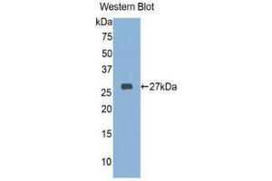 Western Blotting (WB) image for anti-FK506 Binding Protein 3, 25kDa (FKBP3) (AA 2-224) antibody (ABIN1078042)