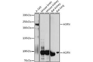 Western blot analysis of extracts of various cell lines, using AGRN antibody (ABIN7265516) at 1:1000 dilution. (AGRN antibody  (AA 30-350))