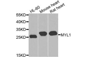 Western blot analysis of extracts of various cell lines, using MYL1 antibody. (MYL1 antibody  (AA 1-150))