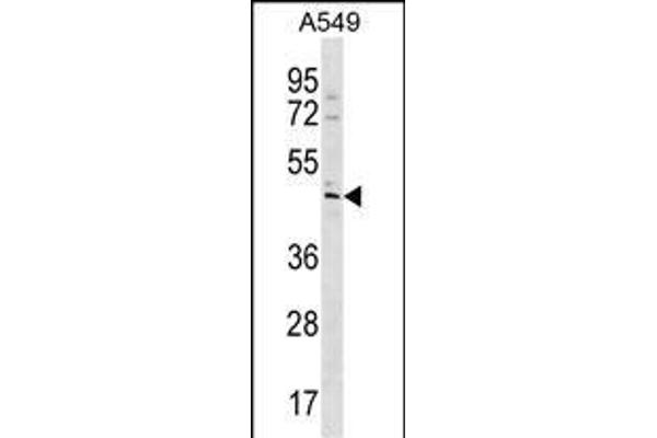 TBC1D20 anticorps  (C-Term)