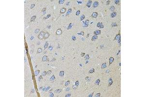 Immunohistochemistry of paraffin-embedded rat brain using CDH16 antibody. (Cadherin-16 antibody  (AA 19-230))