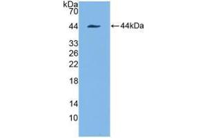 Western blot analysis of recombinant Human KRT7.