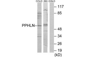 Western Blotting (WB) image for anti-Periphilin 1 (PPHLN1) (Internal Region) antibody (ABIN1849790) (PPHLN1 antibody  (Internal Region))