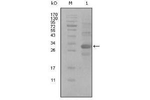 Western Blot showing ALCAM antibody used against truncated Trx-ALCAM recombinant protein (1). (CD166 antibody  (AA 405-524))