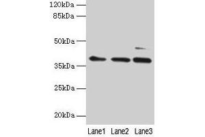 Western blot All lanes: MRPL3 antibody at 6 μg/mL Lane 1: Hela whole cell lysate Lane 2: HepG2 whole cell lysate Lane 3: A549 whole cell lysate Secondary Goat polyclonal to rabbit IgG at 1/10000 dilution Predicted band size: 39 kDa Observed band size: 39 kDa (MRPL3 antibody  (AA 201-348))