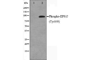 EPS15 抗体  (pTyr849)