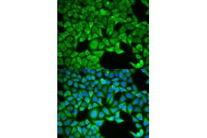 Immunofluorescence analysis of HeLa cells using SLC3A1 antibody. (SLC3A1 antibody  (AA 416-685))