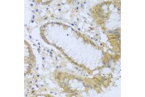 Immunohistochemistry of paraffin-embedded human stomach using  antibody (ABIN6127321, ABIN6136446, ABIN6136448 and ABIN6216005) at dilution of 1:100 (40x lens). (ACP1 antibody  (AA 1-158))