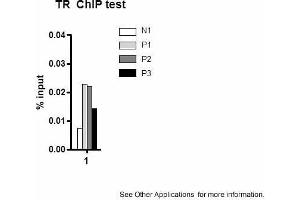Application: ChIPSample type: mouse liver tissueChromatin Used: 100ug tissueAntibody Used: 10ug  Image Submitted by: Joanna DiSpirito, University of Pennsylvania (THRB antibody  (N-Term))