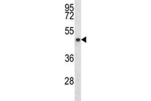 SIRT3 antibody western blot analysis in MDA-MB453 lysate. (SIRT3 antibody  (AA 56-84))