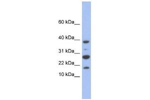 NDUFC1 antibody used at 1 ug/ml to detect target protein. (NDUFC1 antibody)