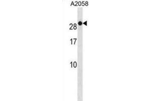 Western Blotting (WB) image for anti-RAB7B, Member RAS Oncogene Family (RAB7B) antibody (ABIN3001226) (RAB7B antibody)