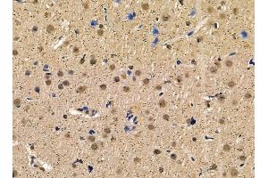 ABIN7095427 and ABIN7099484 at 1/100 staining rat brain tissue by IHC-P. (DPY30 antibody)