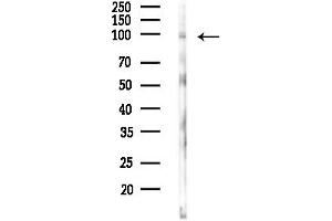 anti-Involucrin (IVL) antibody